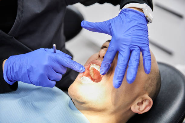 Best Emergency Wisdom Teeth Removal in Chuluota, FL